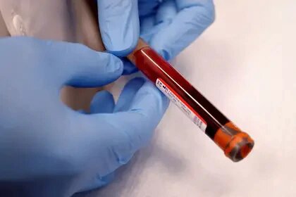 Una farmacéutica desarrolló un nuevo anticuerpo que bloqueó al coronavirus en una prueba de laboratorio