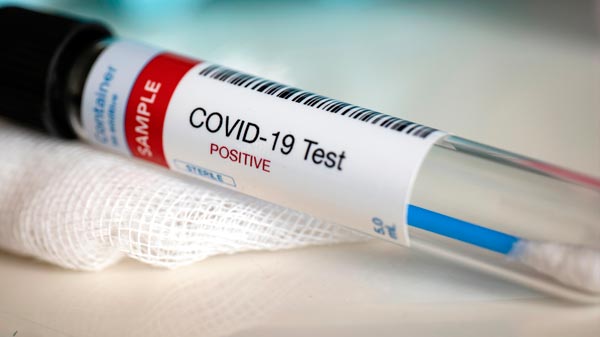 Este viernes se registraron tres nuevos casos de coronavirus en Entre Ríos y el total asciende a 72