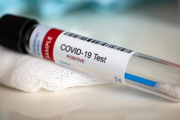 Este lunes se registraron 16 nuevos casos de coronavirus en Entre Ríos