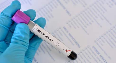 Salud recomienda completar esquemas de vacunación Covid para estar preparados ante un posible brote
